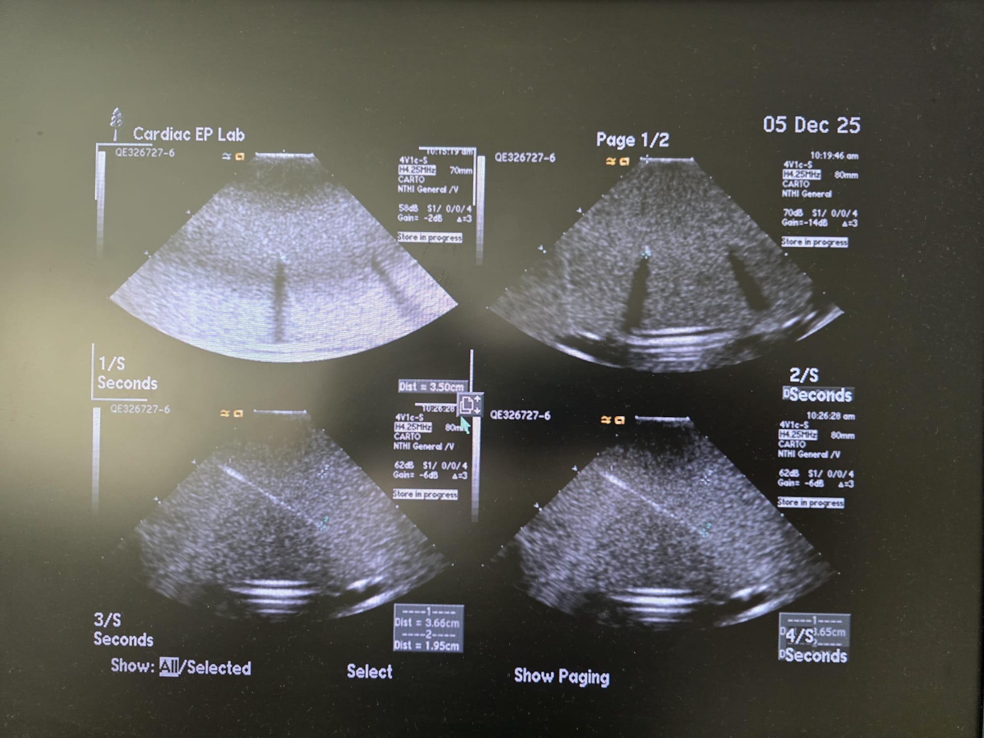 Cardiac ultrasound imaging at Aleph University labs